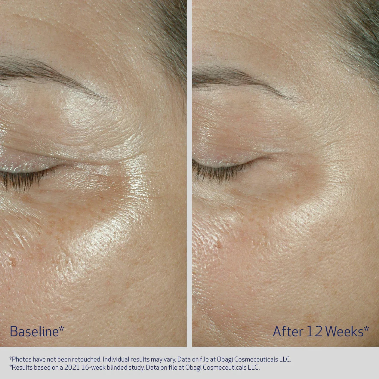 ELASTIDERM® EYE CREAM