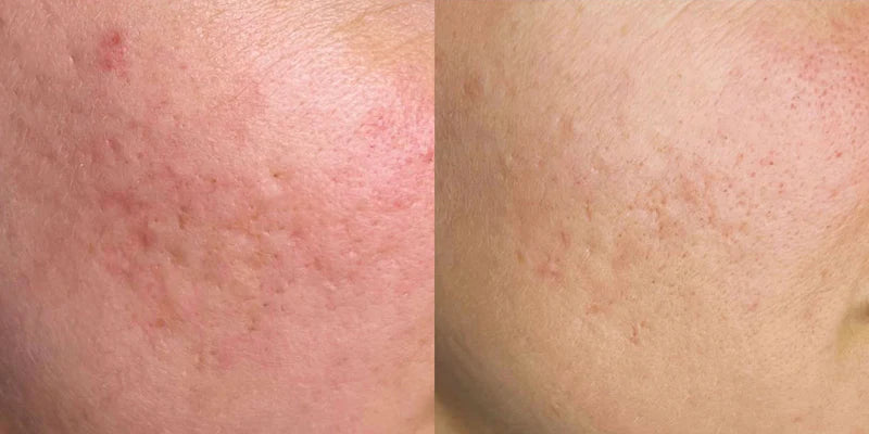 AnteAGE Growth Factor Solution