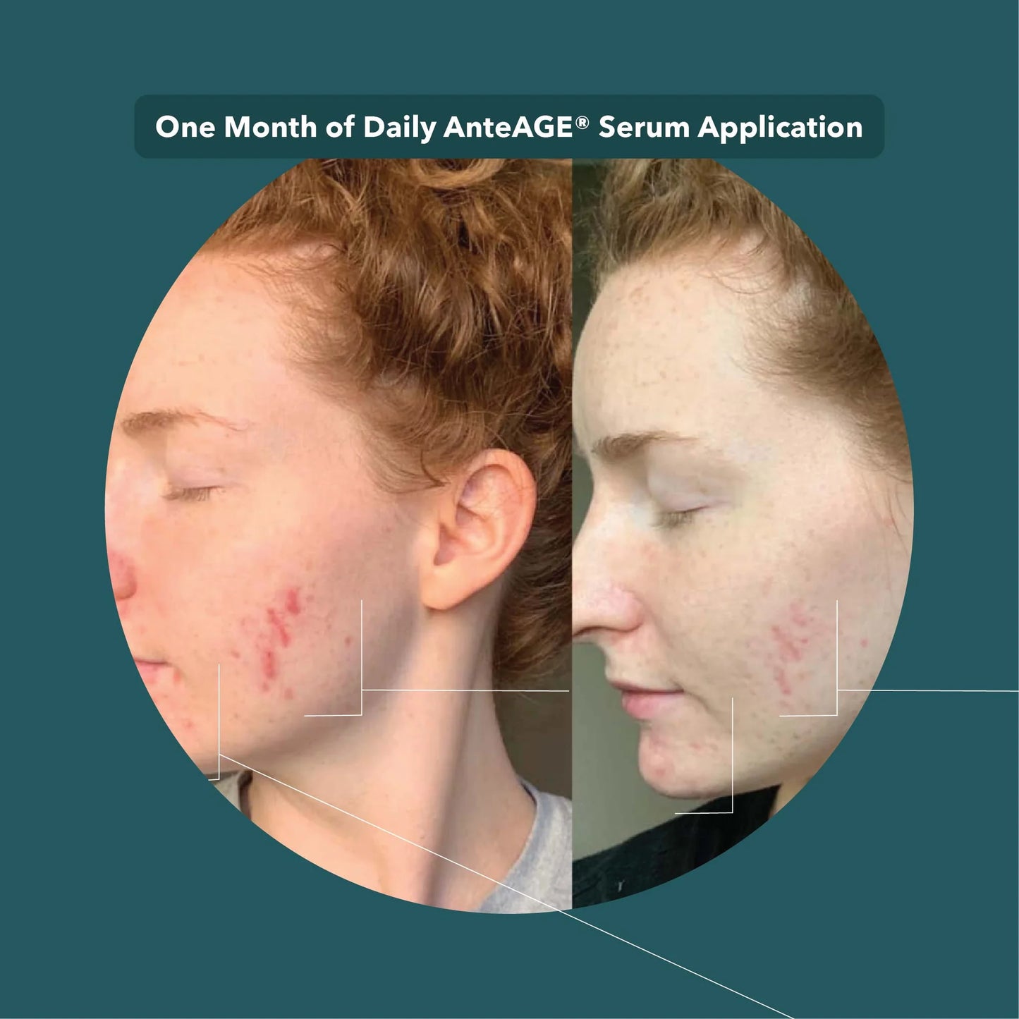 Anteage Serum